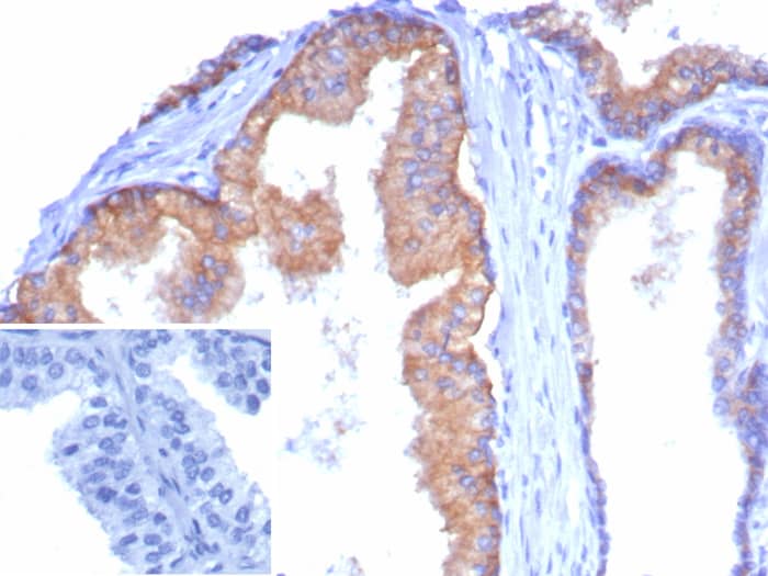 Formalin-fixed, paraffin-embedded human tonsil stained with CD38 antibody (CD38/8335R). Inset: PBS instead of primary antibody; secondary only negative control.