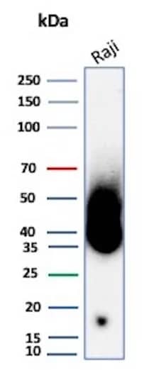 Western Blot Analysis of human kidney tissue lysate using CD38 Antibody (CD38/8335R).