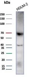 Western Blot: Perforin Antibody (rPRF1/8058) [NBP3-23638] - Western blot analysis of HDLM-2 cell lysate using Perforin Antibody (rPRF1/8058)