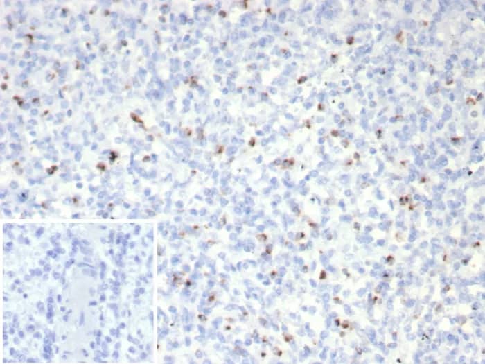 Immunohistochemistry-Paraffin: Perforin Antibody (rPRF1/8058) [NBP3-23638] - Formalin-fixed, paraffin-embedded human spleen stained with Perforin Antibody (rPRF1/8058). Inset: PBS instead of primary antibody; secondary only negative control.