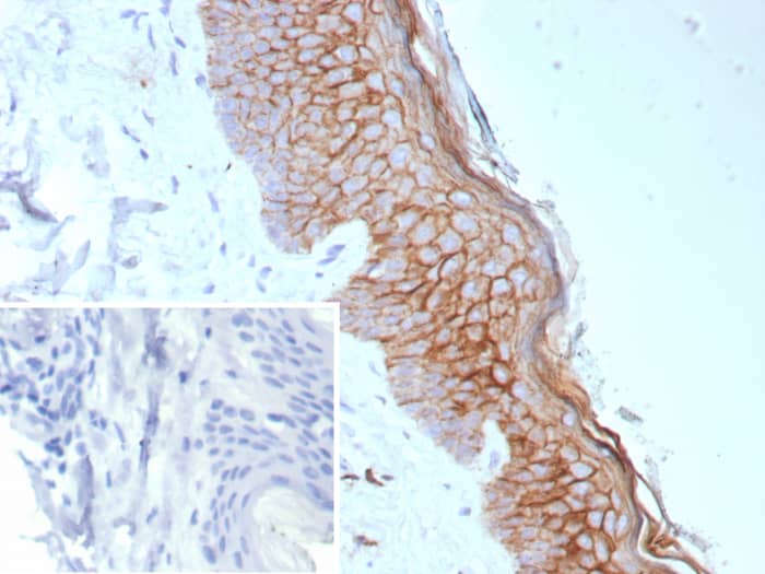 Formalin-fixed, paraffin-embedded human skin stained with S100 calcium binding protein A14 antibody (S100A14/9077R). Inset: PBS instead of primary antibody; secondary only negative control.