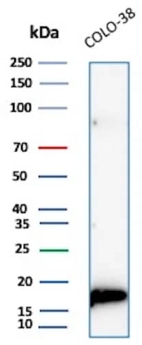 Western Blot Analysis of Colo-38 lysate using Melan-A/MART-1 Antibody (rMLANA/9404).