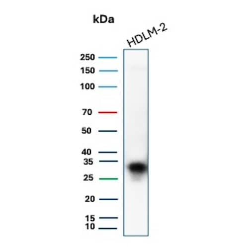 Western Blot Analysis of HDLM-2 cell lysate using HLA DQ/DR/DP Antibody (rHLA-Pan/8847).