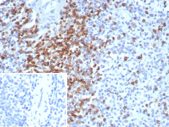 Formalin-fixed, paraffin-embedded human spleen stained with CD2 antibody (LFA2/8681R). HIER: Tris/EDTA, pH9.0, 45min. Secondary: HRP-polymer, 30min. DAB, 5min.
