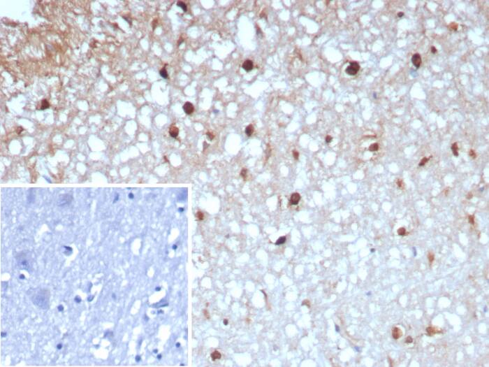 Formalin-fixed, paraffin-embedded human brain stained with Glutamine Synthetase antibody (GLUL/8996R). Inset: PBS instead of primary antibody; secondary only negative control.