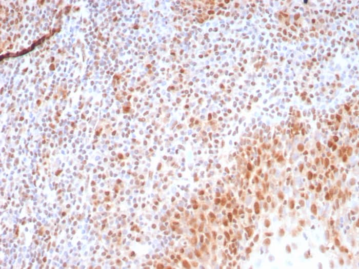 Formalin-fixed, paraffin-embedded human tonsil stained with PCNA antibody (rPCNA/8858) at 2ug/ml. HIER: Tris/EDTA, pH9.0, 45min. Secondary: HRP-polymer, 30min. DAB, 5min.