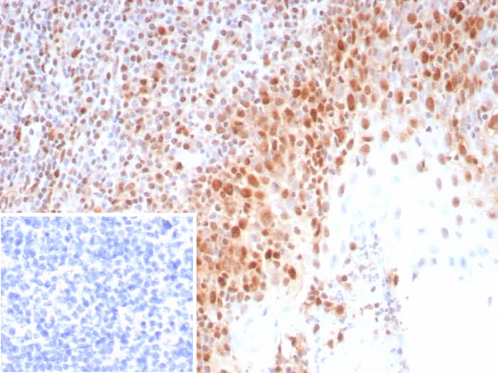 Formalin-fixed, paraffin-embedded human tonsil stained with PCNA antibody (rPCNA/8858) at 2ug/ml. Inset: PBS instead of primary antibody; secondary only negative control.