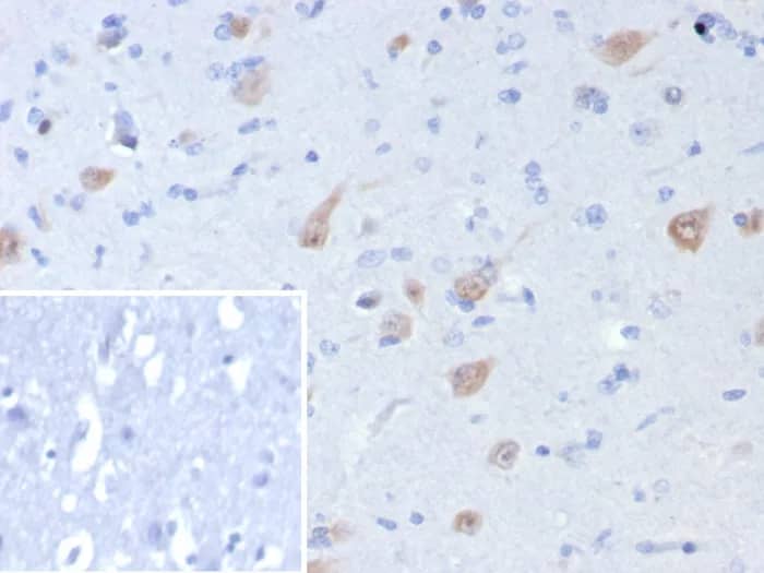 Immunohistochemistry-Paraffin: RBFOX3/NeuN Antibody (rNEUN/8055) [NBP3-23673] - Formalin-fixed, paraffin-embedded human brain stained with RBFOX3/NeuN Antibody (rNEUN/8055). Inset: PBS instead of primary antibody; secondary only negative control.