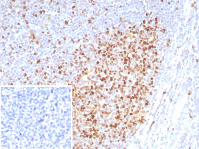 Formalin-fixed, paraffin-embedded human tonsil stained with PCNA antibody (rPCNA/8859) at 2ug/ml. Inset: PBS instead of primary antibody; secondary only negative control.