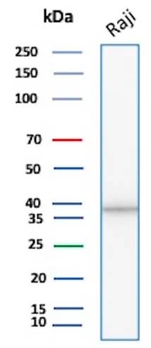 Western Blot Analysis of Raji lysate using PCNA Antibody (rPCNA/8859).