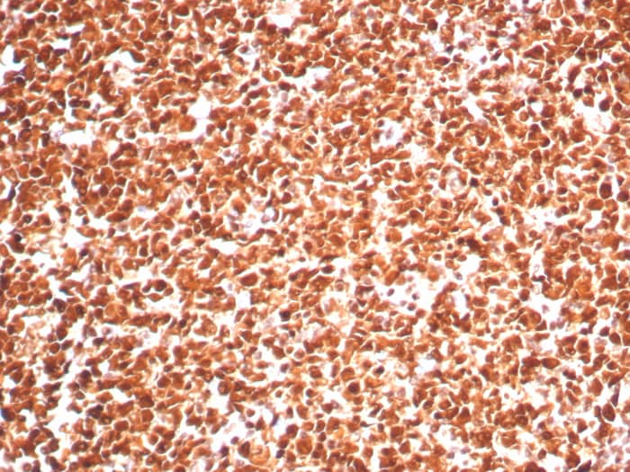 Formalin-fixed, paraffin-embedded human tonsil stained with PCNA antibody (PCNA/8303R). HIER: Tris/EDTA, pH9.0, 45min. Secondary: HRP-polymer, 30min. DAB, 5min.