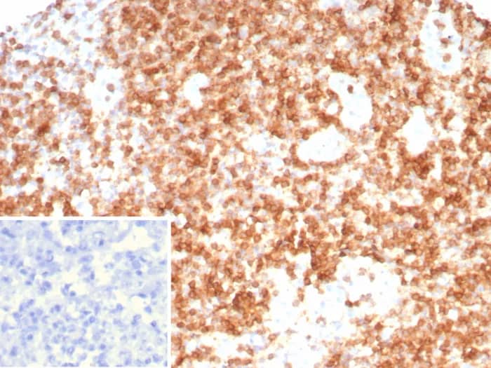 Immunohistochemistry-Paraffin: CD3 gamma Antibody (CD3G/8794) [NBP3-23689] - Formalin-fixed, paraffin-embedded human lymph node stained with CD3 gamma Antibody (CD3G/8794). Inset: PBS instead of primary antibody; secondary only negative control.