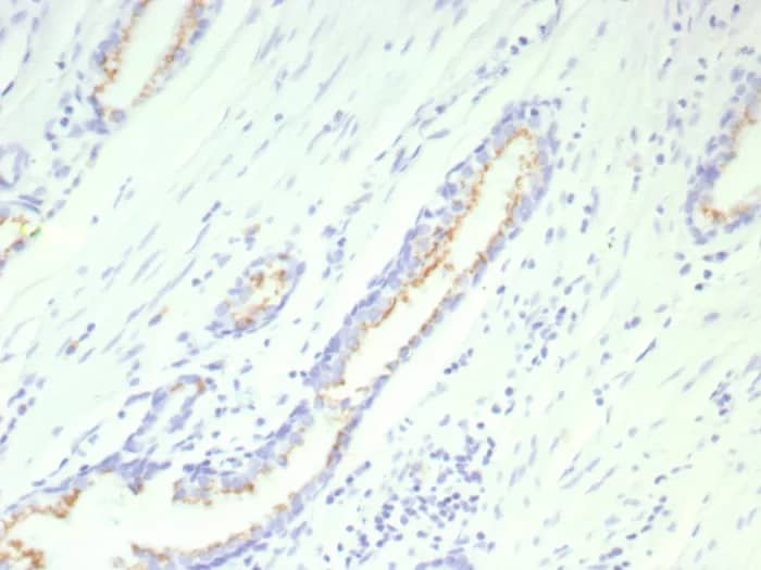 Immunohistochemistry-Paraffin: SLC45A3/Prostein Antibody (SLC45A3/9216R) [NBP3-23691] - Formalin-fixed, paraffin-embedded human prostate stained with SLC45A3/Prostein Antibody (SLC45A3/9216R). HIER: Tris/EDTA, pH9.0, 45min. 2°C: HRP-polymer, 30min. DAB, 5min.
