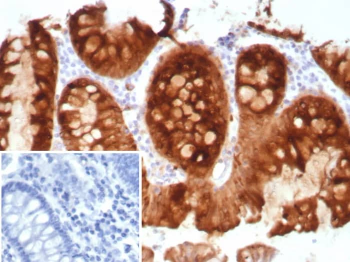 Immunohistochemistry-Paraffin: TFF1/pS2 Antibody (TFF1/8817R) [NBP3-23692] - Formalin-fixed, paraffin-embedded human colon stained with TFF1/pS2 Antibody (TFF1/8817R). Inset: PBS instead of primary antibody; secondary only negative control.