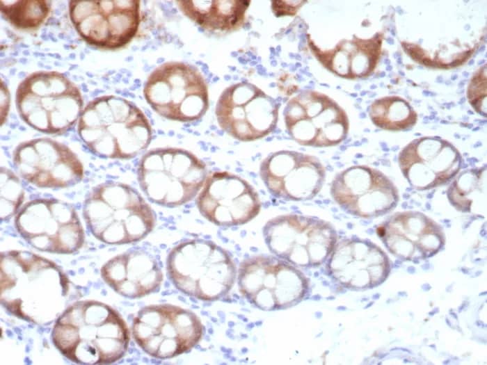 Immunohistochemistry-Paraffin: TFF1/pS2 Antibody (TFF1/8817R) [NBP3-23692] - Formalin-fixed, paraffin-embedded human colon stained with TFF1/pS2 Antibody (TFF1/8817R). HIER: Tris/EDTA, pH9.0, 45min. 2°C: HRP-polymer, 30min. DAB, 5min