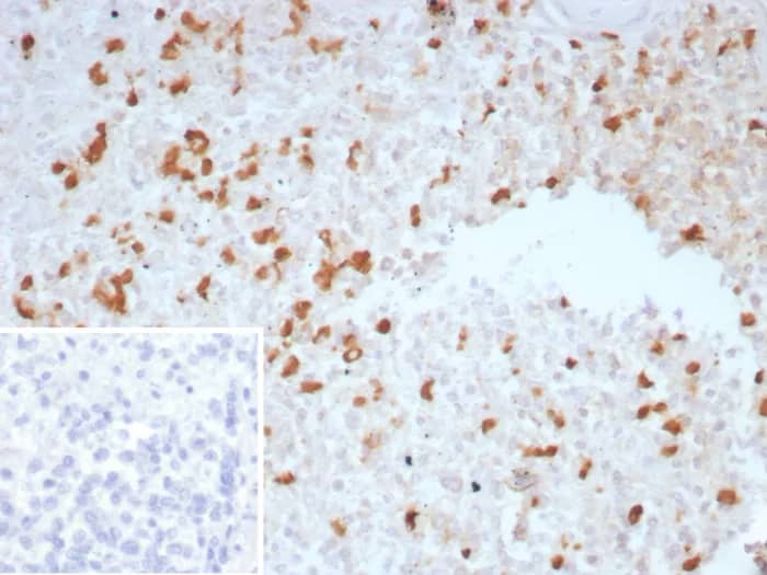 Immunohistochemistry-Paraffin: TGF-beta Antibody (TGFB/7230) [NBP3-23694] - Formalin-fixed, paraffin-embedded human spleen stained with TGF-beta Antibody (TGFB/7230). Inset: PBS instead of primary antibody; secondary only negative control.