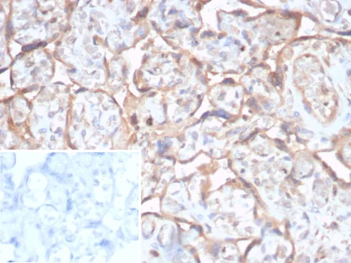 Immunohistochemistry-Paraffin: TGF-beta Antibody (TGFB/7240) [NBP3-23695] - Formalin-fixed, paraffin-embedded human placenta stained with TGF-beta Antibody (TGFB/7240). Inset: PBS instead of primary antibody; secondary only negative control.