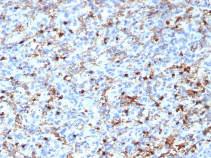 Immunohistochemistry-Paraffin: CD163L1 Antibody (CD163L1/7971) [NBP3-23697] - Formalin-fixed, paraffin-embedded human spleen stained with CD163L1 Antibody (CD163L1/7971). HIER: Tris/EDTA, pH9.0, 45min. 2°C: HRP-polymer, 30min. DAB, 5min.