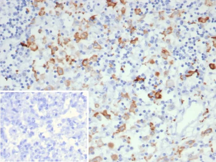 Immunohistochemistry-Paraffin: CD163L1 Antibody (CD163L1/7971) [NBP3-23697] - Formalin-fixed, paraffin-embedded human lymph node stained with CD163L1 Antibody (CD163L1/7971). Inset: PBS instead of primary antibody; secondary only negative control.