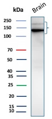 Western Blot Analysis of Human Brain lysate using L1CAM Antibody (L1CAM/9267R)