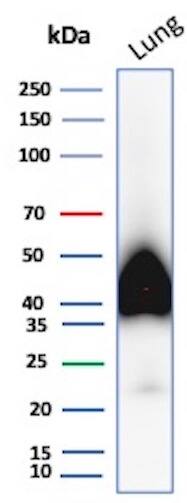 Western blot analysis of human Lung tissue lysate using Podoplanin Antibody (PDPN/8950R).