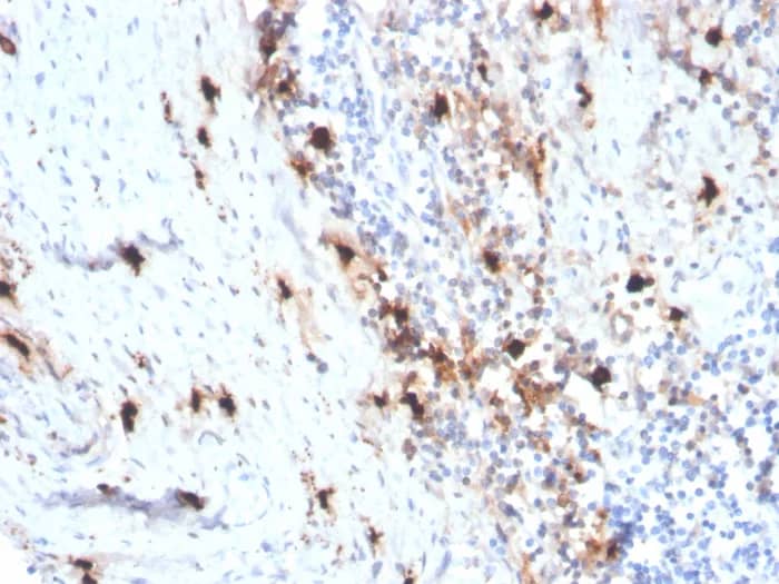 Immunohistochemistry-Paraffin: Tryptase alpha/beta 1 Antibody (rTPSAB1/1963) [NBP3-23713] - Formalin-fixed, paraffin-embedded human tonsil stained with Tryptase alpha/beta 1 Antibody (rTPSAB1/1963). HIER: Tris/EDTA, pH9.0, 45min. 2°C: HRP-polymer, 30min. DAB, 5min.