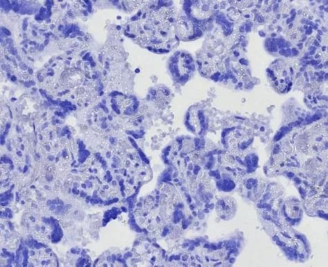 Immunohistochemistry-Paraffin: CD163L1 Antibody (CD163L1/7972) [NBP3-23716] - IHC analysis of formalin-fixed, paraffin-embedded human placenta. Negative tissue control using CD163L1 Antibody (CD163L1/7972) at 2ug/ml in PBS for 30min RT. HIER: Tris/EDTA, pH9.0, 45min. 2°C: HRP-polymer, 30min. DAB, 5min.