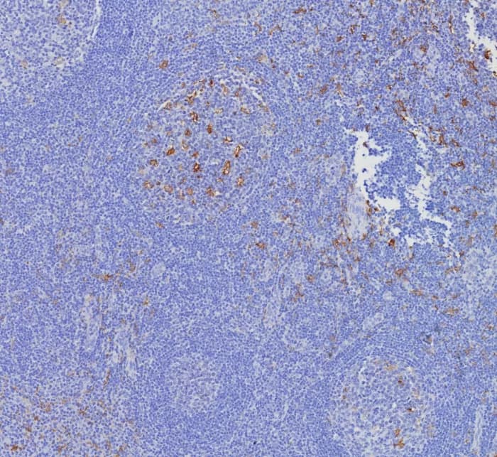 Immunohistochemistry-Paraffin: CD163L1 Antibody (CD163L1/7972) [NBP3-23716] - Formalin-fixed, paraffin-embedded human tonsil stained with CD163L1 Antibody (CD163L1/7972). HIER: Tris/EDTA, pH9.0, 45min. 2°C: HRP-polymer, 30min. DAB, 5min.