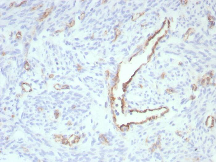 Formalin-fixed, paraffin-embedded human uterus stained withCD31/PECAM-1 antibody (rPECAM1/8826). HIER: Tris/EDTA, pH9.0, 45min. Secondary: HRP-polymer, 30min. DAB, 5min.