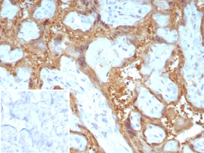 Immunohistochemistry-Paraffin: Galectin 13 Antibody (PP13/8897) [NBP3-23729] - Formalin-fixed, paraffin-embedded human placenta stained with Galectin 13 Antibody (PP13/8897). Inset: PBS instead of primary antibody; secondary only negative control.