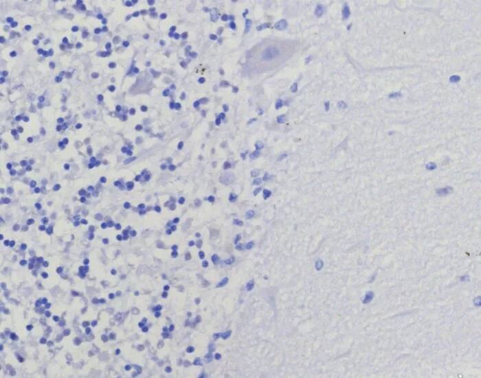Immunohistochemistry-Paraffin: Thymidylate Synthase Antibody (TYMS/9091R) [NBP3-23732] - IHC analysis of formalin-fixed, paraffin-embedded human brain. Negative tissue control using Thymidylate Synthase Antibody (TYMS/9091R) at 2ug/ml in PBS for 30min RT. HIER: Tris/EDTA, pH9.0, 45min. 2°C: HRP-polymer, 30min. DAB, 5min.