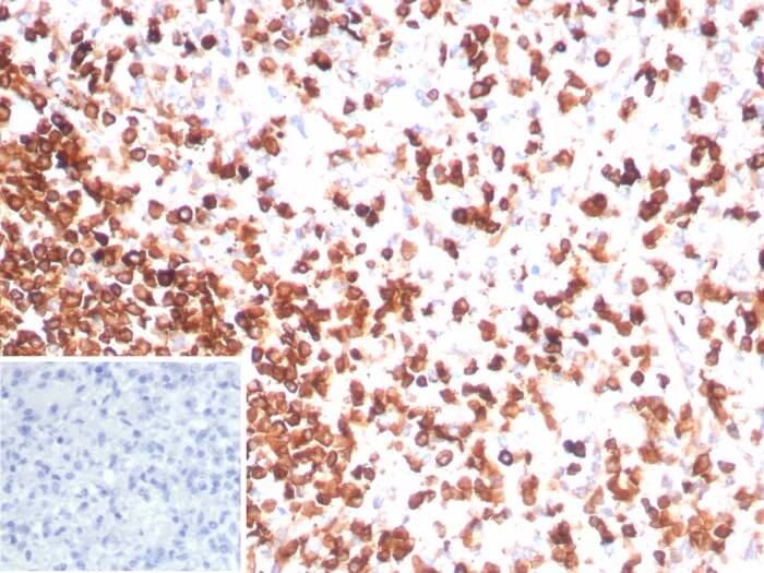 Immunohistochemistry-Paraffin: CD3 epsilon Antibody (rC3e/8881) [NBP3-23733] - Formalin-fixed, paraffin-embedded human spleen stained with CD3 epsilon Antibody (rC3e/8881). Inset: PBS instead of primary antibody; secondary only negative control.
