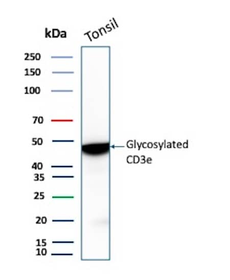 Western Blot Analysis of Human Tonsil tissue lysate using CD3 epsilon Antibody (rC3e/8881).