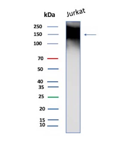 Western blot analysis of Jurkat cell lysate using TAG-72 Antibody (TAG72/8317R).