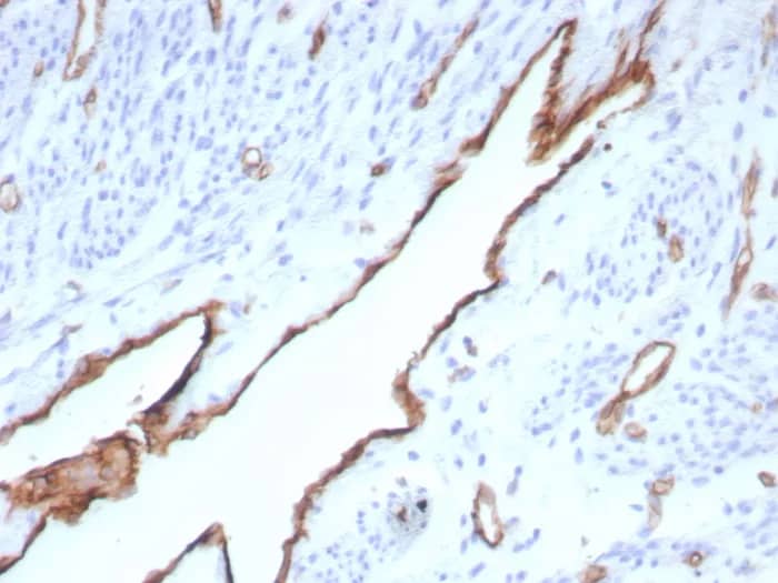 Immunohistochemistry-Paraffin: CD31/PECAM-1 Antibody (rPECAM1/8832) [NBP3-23736] - Formalin-fixed, paraffin-embedded human placenta stained with CD31/PECAM-1 Antibody (rPECAM1/8832). HIER: Tris/EDTA, pH9.0, 45min. 2°C: HRP-polymer, 30min. DAB, 5min.