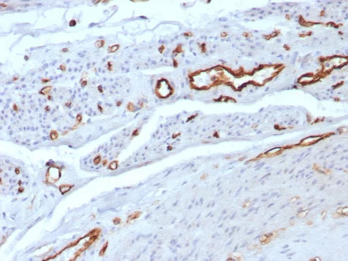 Immunohistochemistry-Paraffin: CD31/PECAM-1 Antibody (C31/8592R) [NBP3-23737] - Formalin-fixed, paraffin-embedded human uterus stained with CD31/PECAM-1 Antibody (C31/8592R). HIER: Tris/EDTA, pH9.0, 45min. 2°C: HRP-polymer, 30min. DAB, 5min.