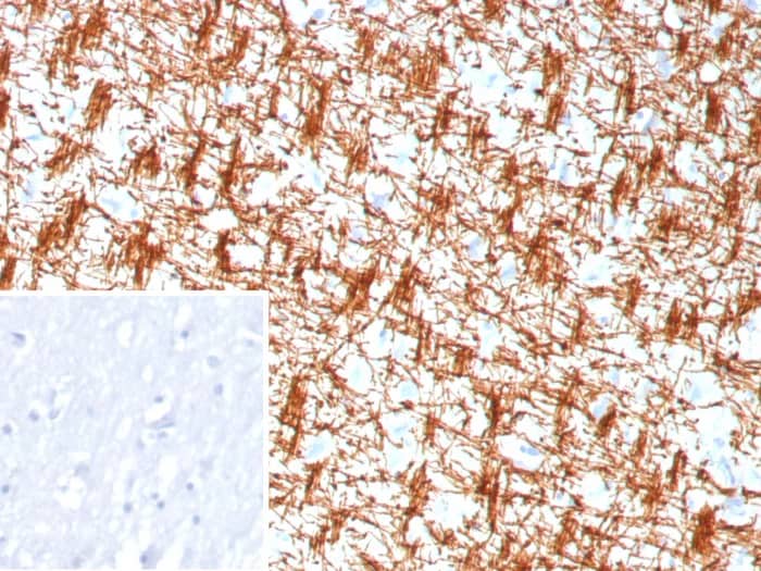 Immunohistochemistry-Paraffin: MBP Antibody (rMBP/9301) [NBP3-23738] - Formalin-fixed, paraffin-embedded human brain stained with MBP Antibody (rMBP/9301). Inset: PBS instead of primary antibody; secondary only negative control.