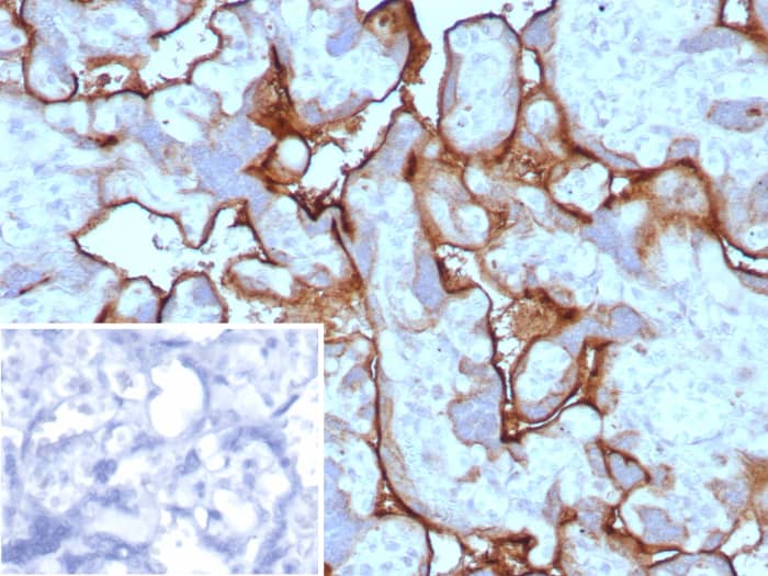 Formalin-fixed, paraffin-embedded human placenta stained withPD-L1 antibody (PDL1/8591R). Inset: PBS instead of primary antibody; secondary only negative control.