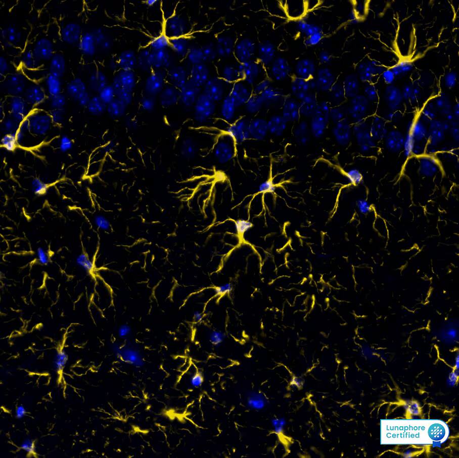 GFAP was detected in immersion fixed paraffin-embedded sections of mouse Brain Cortex using Rabbit Anti-Mouse GFAP Monoclonal Antibody at 0.15ug/mL at 37°Celsius for 2 minutes. Before incubation with the primary antibody, tissue underwent an all-in-one dewaxing and antigen retrieval preprocessing using PreTreatment Module (PT Module) and Dewax and HIER Buffer H (pH 9; Epredia Catalog # TA-999-DHBH). Tissue was stained using the Alexa Fluor™ Plus 555 Goat anti-Rabbit IgG Secondary Antibody at 1:100 at 37°Celsius for 2 minutes. (Yellow; Lunaphore Catalog # DR555RB) and counterstained with DAPI (blue; Lunaphore Catalog # DR100). Specific staining was localized to the astrocytes showing cytoplasmic staining. Protocol available in COMET™ Panel Builder.