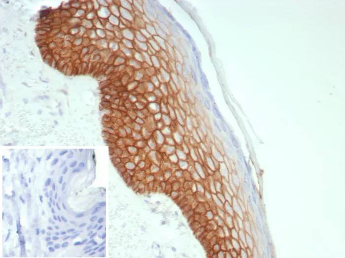 Immunohistochemistry-Paraffin: Desmoglein-3 Antibody (rDSG3/8612) [NBP3-23741] - Formalin-fixed, paraffin-embedded human skin stained with Desmoglein-3 Antibody (rDSG3/8612). Inset: PBS instead of primary antibody; secondary only negative control.