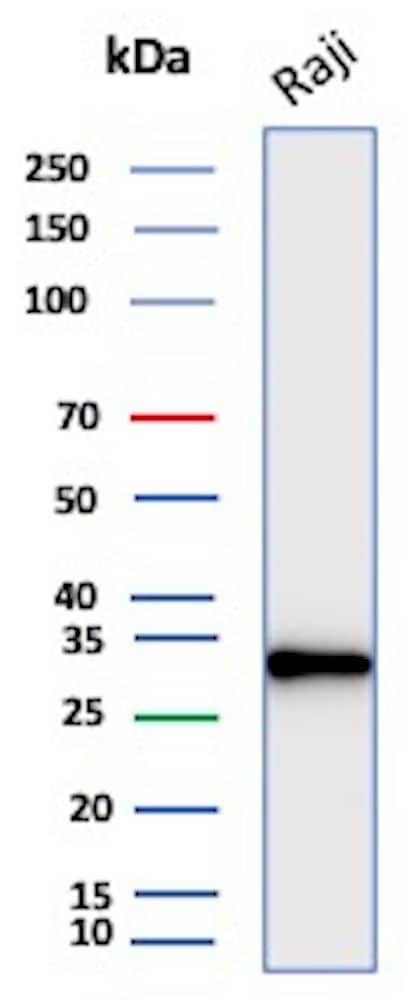 Western Blot Analysis of Raji cell lysate using CD20 Antibody (rMS4A1/8044).