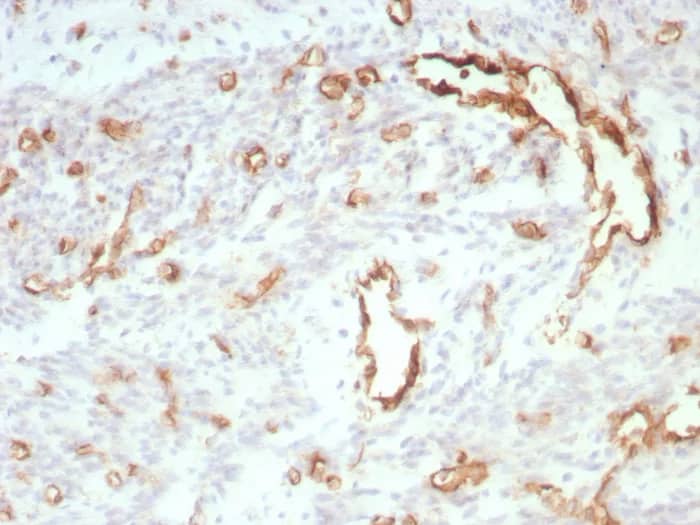 Immunohistochemistry-Paraffin: CD31/PECAM-1 Antibody (C31/8828R) [NBP3-23747] - Formalin-fixed, paraffin-embedded human uterus stained with CD31/PECAM-1 Antibody (C31/8828R). HIER: Tris/EDTA, pH9.0, 45min. 2°C: HRP-polymer, 30min. DAB, 5min.