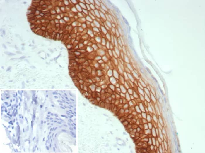 Immunohistochemistry-Paraffin: Desmoglein-3 Antibody (DSG3/8613R) [NBP3-23751] - Formalin-fixed, paraffin-embedded human skin stained with Desmoglein-3 Antibody (DSG3/8613R). Inset: PBS instead of primary antibody; secondary only negative control.