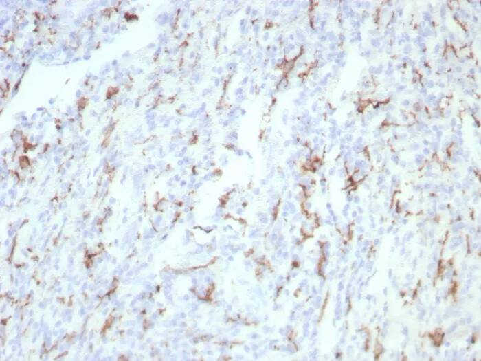 Immunohistochemistry-Paraffin: CD163 Antibody (rM130/8823) [NBP3-23756] - Formalin-fixed, paraffin-embedded human tonsil stained with CD163 Antibody (rM130/8823). HIER: Tris/EDTA, pH9.0, 45min. 2°C: HRP-polymer, 30min. DAB, 5min.