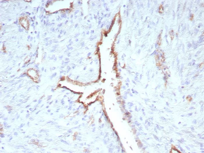 Immunohistochemistry-Paraffin: CD31/PECAM-1 Antibody (C31/9224R) [NBP3-23759] - Formalin-fixed, paraffin-embedded human uterus stained with CD31/PECAM-1 Antibody (C31/9224R). HIER: Tris/EDTA, pH9.0, 45min. 2°C: HRP-polymer, 30min. DAB, 5min.