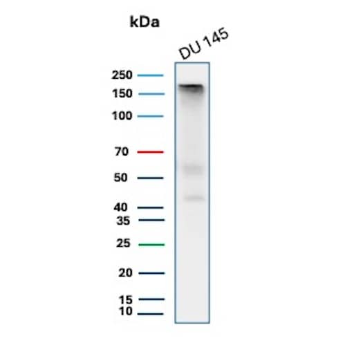 Western Blot Analysis of DU 145 lysate using MSH6 Antibody (MSH6/8338R).