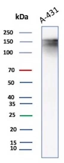 Western Blot Analysis of A431 cell lysate using EGFR Antibody (EGFR/8933R).