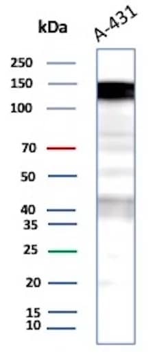 Western Blot Analysis of A431 cell lysate using EGFR Antibody (EGFR/9166R).