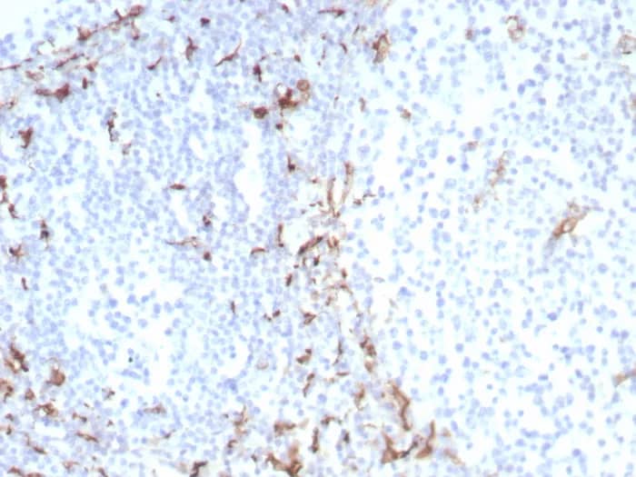 Immunohistochemistry-Paraffin: CD163 Antibody (M130/8822R) [NBP3-23775] - Formalin-fixed, paraffin-embedded human tonsil stained with CD163 Antibody (M130/8822R). HIER: Tris/EDTA, pH9.0, 45min. 2°C: HRP-polymer, 30min. DAB, 5min.