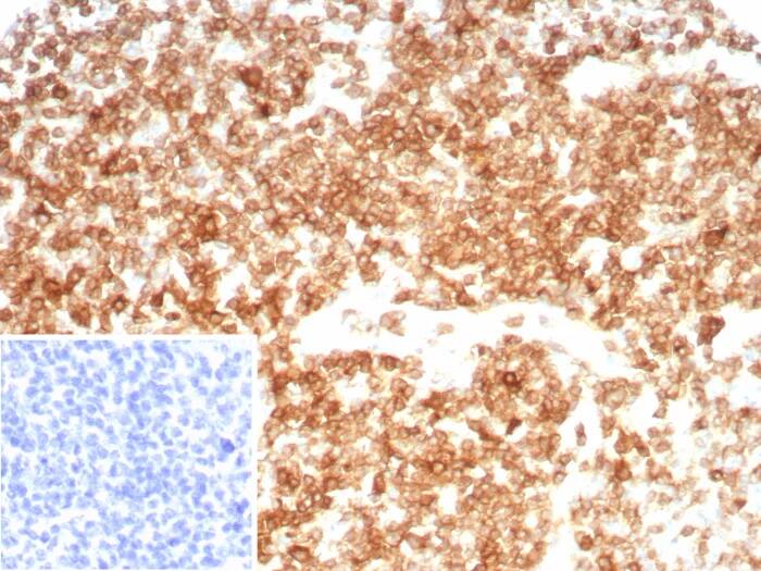 Immunohistochemistry-Paraffin: CD27/TNFRSF7 Antibody (LPFS2/8607R) [NBP3-23776] - Formalin-fixed, paraffin-embedded human tonsil stained with CD27/TNFRSF7 Antibody (LPFS2/8607R). Inset: PBS instead of primary antibody; secondary only negative control.